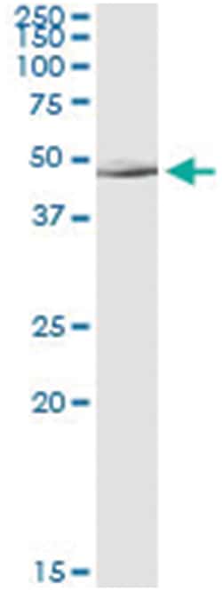 anti-ALLC, Human, IP-WB Antibody Pair, Abnova&trade;
