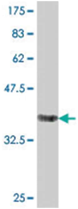VPS11, Mouse, Polyclonal Antibody, Abnova 50&mu;L; Unlabeled:Antibodies,