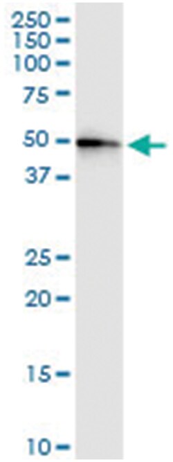 CENPJ, Human, IP-WB Antibody Pair (PW3), Abnova 1 Set:Antibodies, Monoclonal/Polyclonal