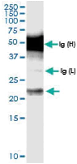 anti-CENPN, Human, IP-WB Antibody Pair, Abnova™