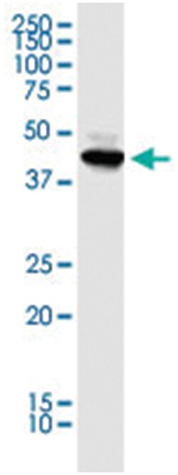 HDAC8, Human, IP-WB Antibody Pair (PW3), Abnova&trade;