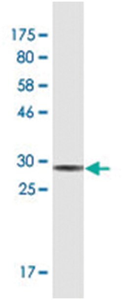 LMO3, Mouse, Clone: 4A8, Abnova 200&mu;L; Unlabeled:Antibodies, Monoclonal