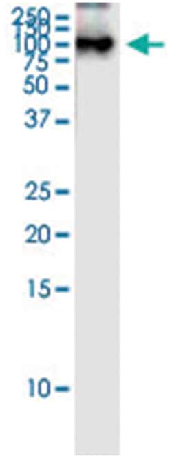 anti-MLL5, Human, IP-WB Antibody Pair, Abnova&trade;