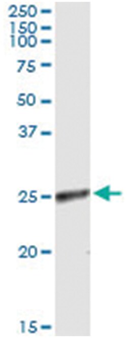 anti-RNF114, Human, IP-WB Antibody Pair, Abnova 1 Set:Antibodies, Monoclonal/Polyclonal