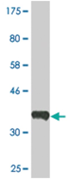 ERBB2IP, Mouse, Clone: 10G1, Abnova 200&mu;L; Unlabeled:Antibodies, Monoclonal
