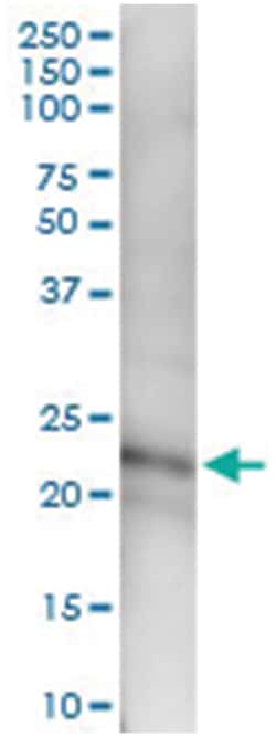CFC1, Human, IP-WB Antibody Pair (PW1), Abnova 1 Set:Antibodies