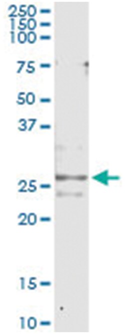 CFC1, Human, IP-WB Antibody Pair (PW2), Abnova&trade;