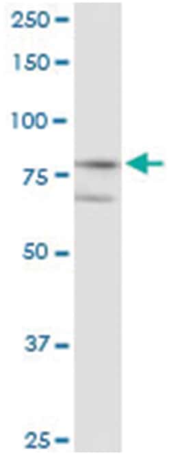 anti-KLHL4, Human, IP-WB Antibody Pair, Abnova™