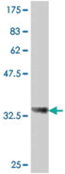 PCDHGB5, Mouse, Polyclonal Antibody, Abnova 50&mu;L; Unlabeled:Antibodies,