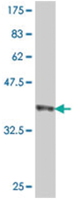 PCDHGA6, Mouse, Polyclonal Antibody, Abnova 50 &mu;L | Buy Online | Abnova | Fisher Scientific
