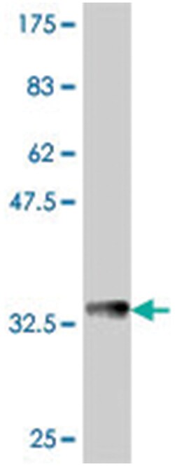PCDHA6, Mouse, Polyclonal Antibody, Abnova 50&mu;L; Unlabeled:Antibodies,