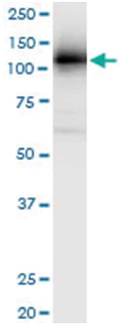 anti-RNF20, Human, IP-WB Antibody Pair, Abnova™
