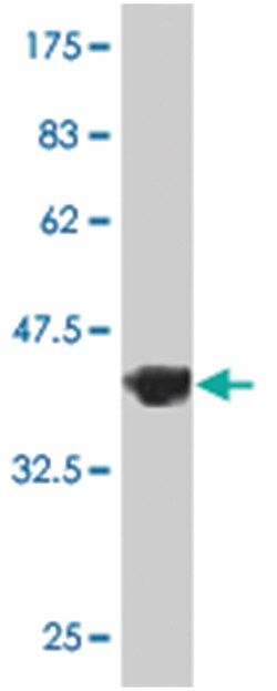 KCNQ5, Mouse, Polyclonal Antibody, Abnova 50 &mu;L | Buy Online | Abnova | Fisher Scientific