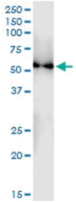 anti-TUBB4Q, Human, IP-WB Antibody Pair, Abnova&trade;