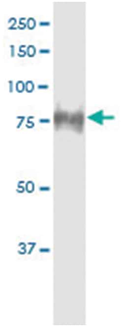anti-INPP5E, Human, IP-WB Antibody Pair, Abnova&trade;