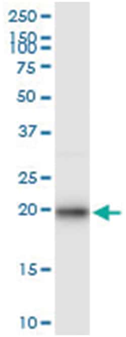 anti-EIF5A2, Human, IP-WB Antibody Pair, Abnova 1 Set:Antibodies, Monoclonal/Polyclonal