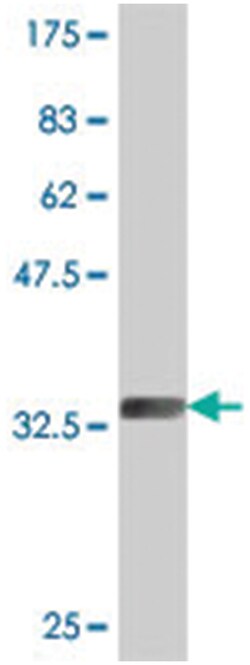 KCNK12, Mouse, Polyclonal Antibody, Abnova 50 &mu;L | Buy Online | Abnova | Fisher Scientific