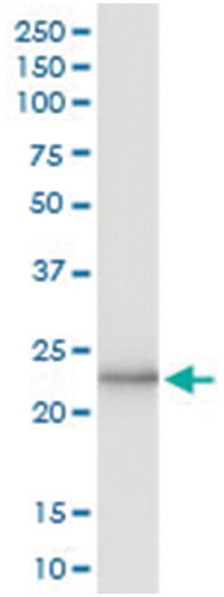 anti-C11ORF17, Human, IP-WB Antibody Pair, Abnova 1 Set:Antibodies, Monoclonal/Polyclonal