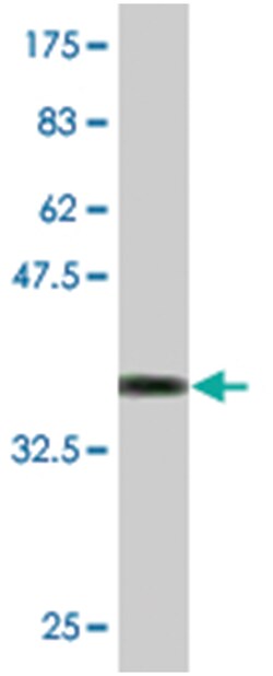 RETN, Mouse, Clone: 4B11, Abnova 200&mu;L; Unlabeled:Antibodies, Monoclonal
