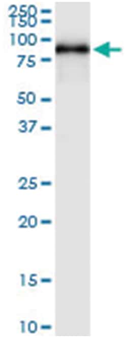 anti-SPHK2, Human, IP-WB Antibody Pair, Abnova™