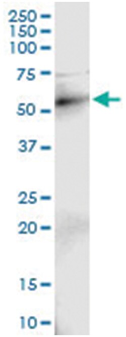 Abnova Corporation anti-RAD18, Human, IP-WB Antibody Pair, Abnova™