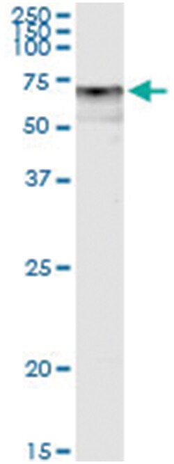 Abnova Corporation anti-DPYSL5, Human, IP-WB Antibody Pair, Abnova™