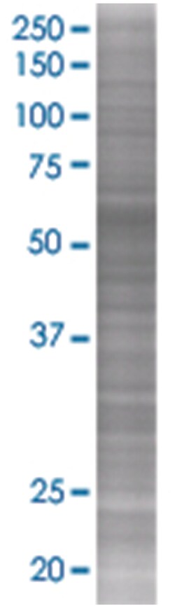 DPYSL5 293T Cell Overexpression Lysate (Denatured), Abnova 100 &mu;L | Buy Online | Abnova Corporation | Fisher Scientific