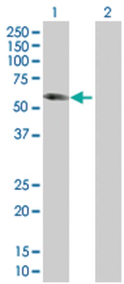 DPYSL5 293T Cell Overexpression Lysate (Denatured), Abnova 100 &mu;L | Buy Online | Abnova Corporation | Fisher Scientific