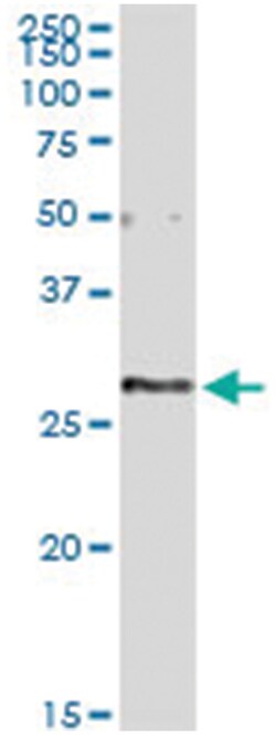 anti-EXOSC5, Human, IP-WB Antibody Pair, Abnova 1 Set:Antibodies, Monoclonal/Polyclonal