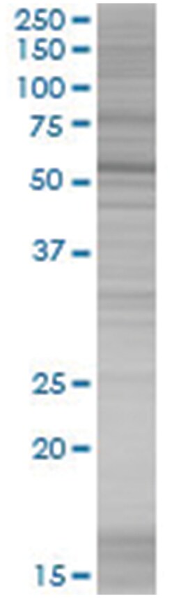 MEIS3 293T Cell Overexpression Lysate (Denatured), Abnova 100 &mu;L | Buy Online | Abnova | Fisher Scientific