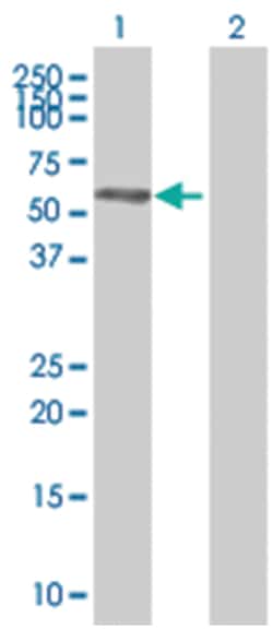 MEIS3 293T Cell Overexpression Lysate (Denatured), Abnova 100 &mu;L | Buy Online | Abnova | Fisher Scientific