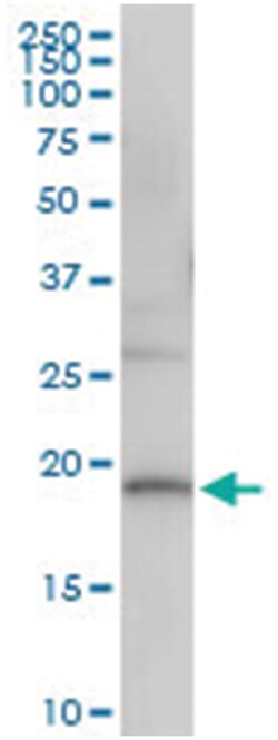anti-DUSP22, Human, IP-WB Antibody Pair, Abnova 1 Set:Antibodies, Monoclonal/Polyclonal