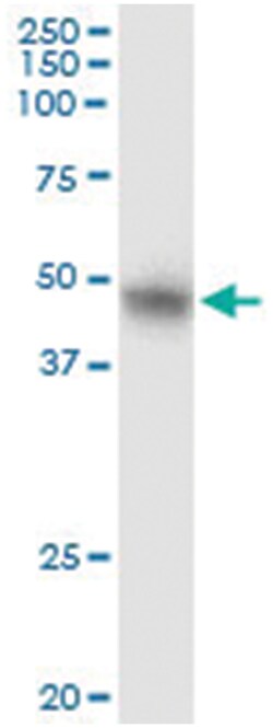 SMYD2, Human, IP-WB Antibody Pair (PW1), Abnova 1 Set:Antibodies, Monoclonal/Polyclonal