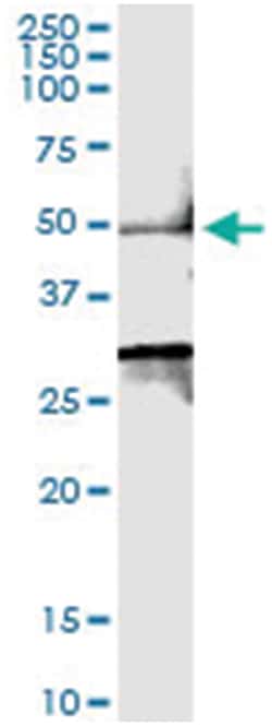 SMYD2, Human, IP-WB Antibody Pair (PW2), Abnova&trade;