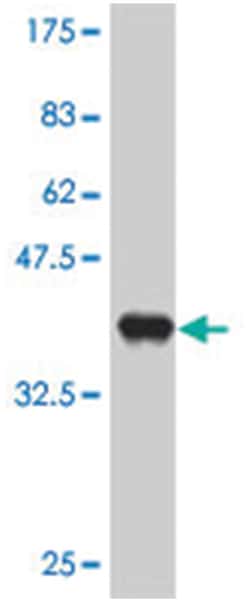PCBP4, Mouse, Polyclonal Antibody, Abnova 50&mu;L; Unlabeled:Antibodies,