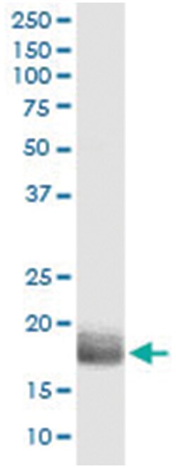 anti-AGTRAP, Human, IP-WB Antibody Pair, Abnova™