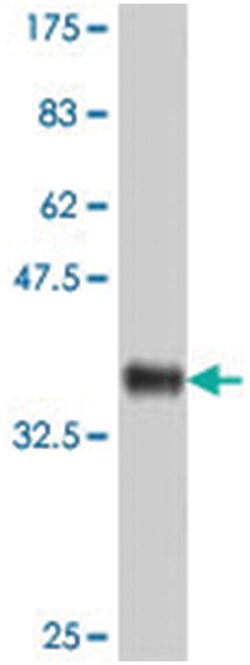 REXO4 (XPMC2H), Mouse, Polyclonal Antibody, Abnova 50&mu;L; Unlabeled:Antibodies,