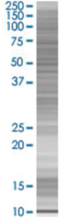 ZNF695 293T Cell Overexpression Lysate (Denatured), Abnova 100 &mu;L | Buy Online | Abnova | Fisher Scientific