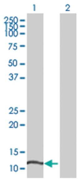 ZNF695 293T Cell Overexpression Lysate (Denatured), Abnova 100 &mu;L | Buy Online | Abnova | Fisher Scientific