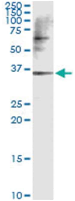 anti-CAMK1D, Human, IP-WB Antibody Pair, Abnova&trade;