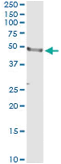 Abnova Corporation&nbsp;anti-CD177, Human, IP-WB Antibody Pair, Abnova&trade;