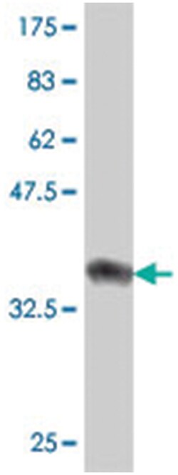 CHMP1B, Mouse, Polyclonal Antibody, Abnova 50&mu;L; Unlabeled:Antibodies,