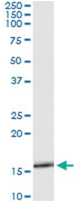anti-SLURP1, Human, IP-WB Antibody Pair, Abnova™
