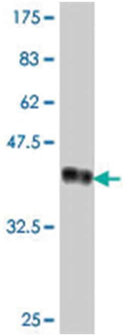 SMURF1, Mouse, Polyclonal Antibody, Abnova 50&mu;L; Unlabeled:Antibodies,
