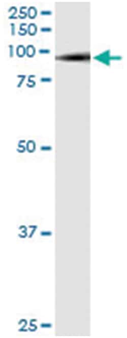 anti-SMURF1, Human, IP-WB Antibody Pair, Abnova&trade;