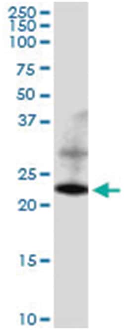 anti-RAB22A, Human, IP-WB Antibody Pair, Abnova&trade;