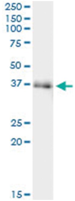 anti-FAM62B, Human, IP-WB Antibody Pair, Abnova 1 Set:Antibodies, Monoclonal/Polyclonal