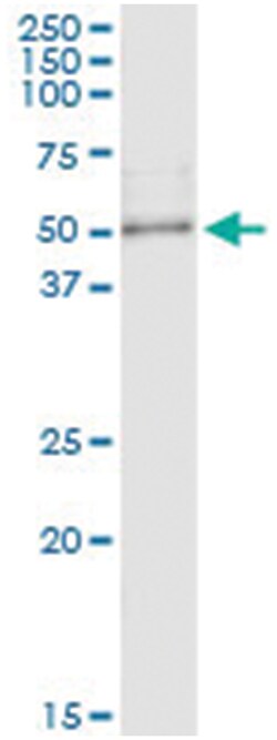 RPTOR, Human, IP-WB Antibody Pair (PW1), Abnova&trade;