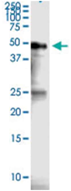 RPTOR, Human, IP-WB Antibody Pair (PW2), Abnova™