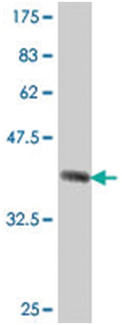 HACE1, Mouse, Polyclonal Antibody, Abnova 50&mu;L; Unlabeled:Antibodies,